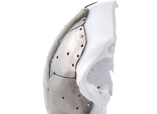 Renishaw surađuje u proizvodnji jedinstvenih kirurških implantata Renishaw surađuje u proizvodnji jedinstvenih kirurških implantata