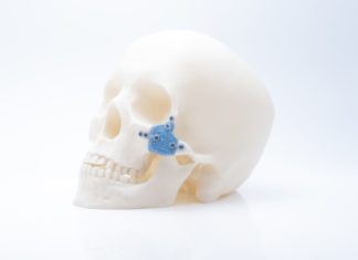 LITHOZ O PIONIRSKIM MEDICINSKIM PRIMJENAMA 3D PRINTANIH KERAMIČKIH MATERIJALA